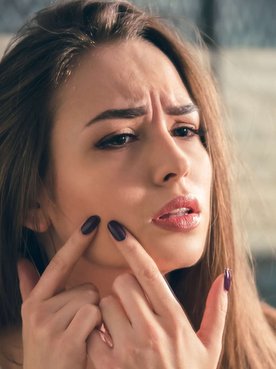 Acne Filtro Solar Cuidado Com Pele