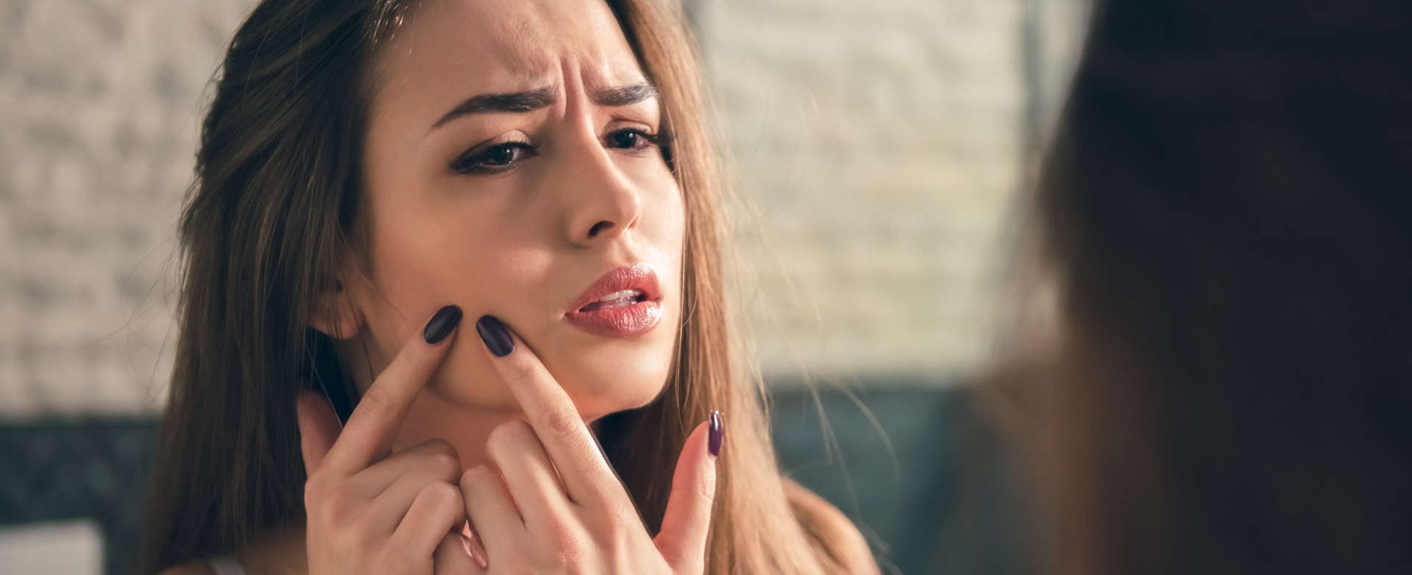mulher com acne em frente ao espelho