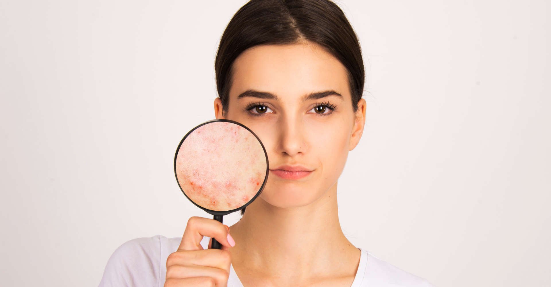 mulher mostra pele ressecada e danificada