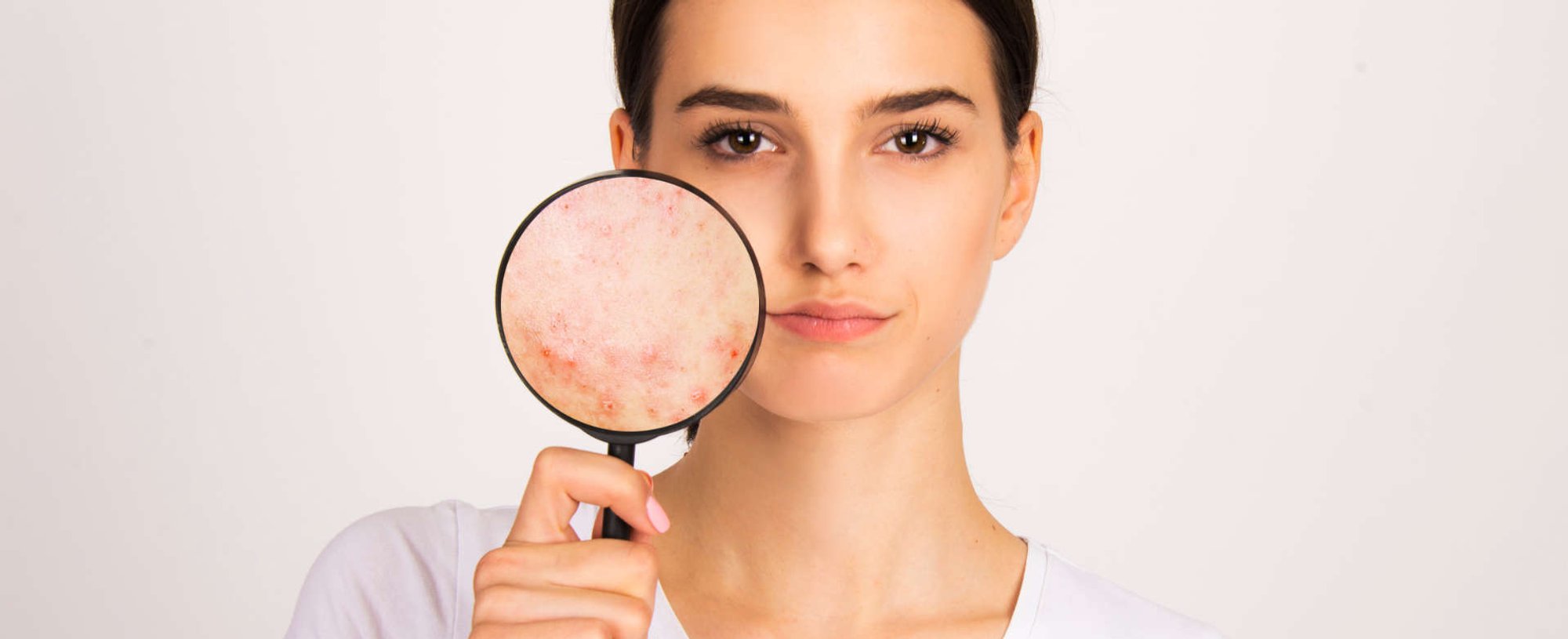 mulher mostra pele ressecada e danificada