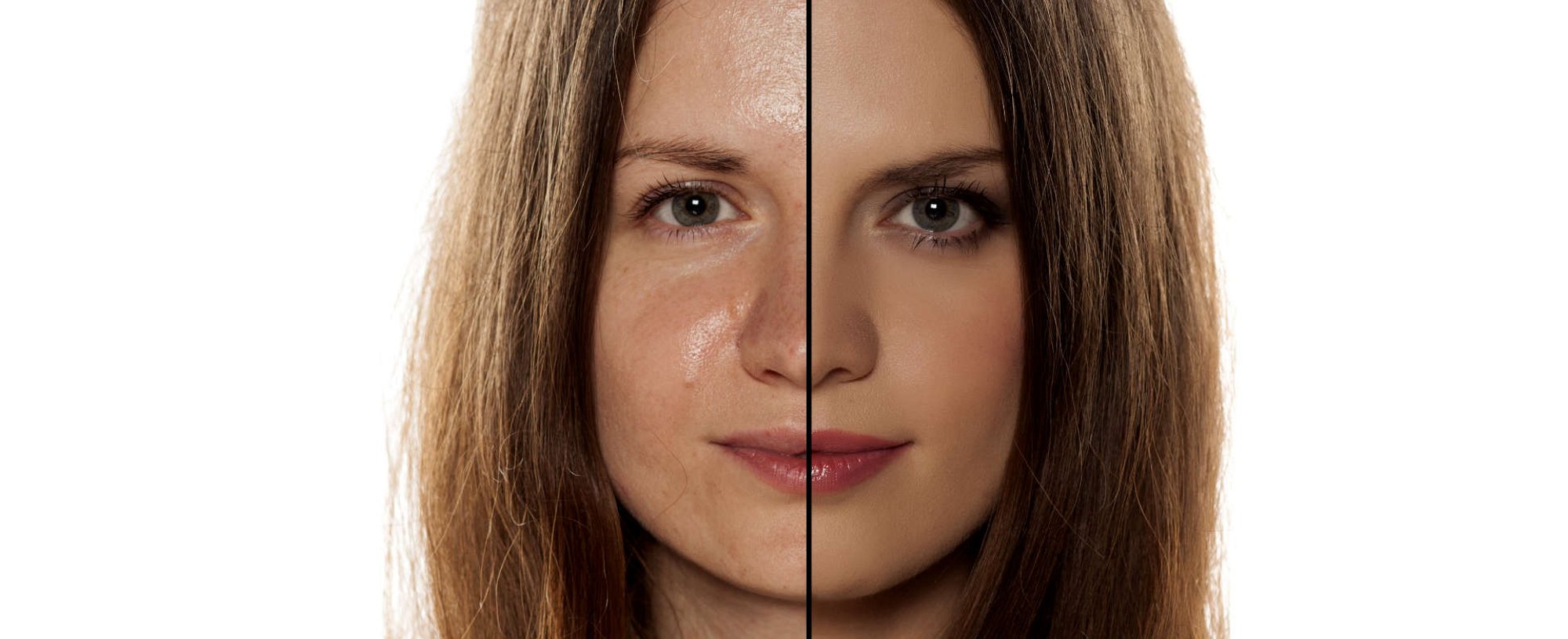 rosto dividido ao meio, um lado a pele oleosa e do outro a pele limpa e tratada