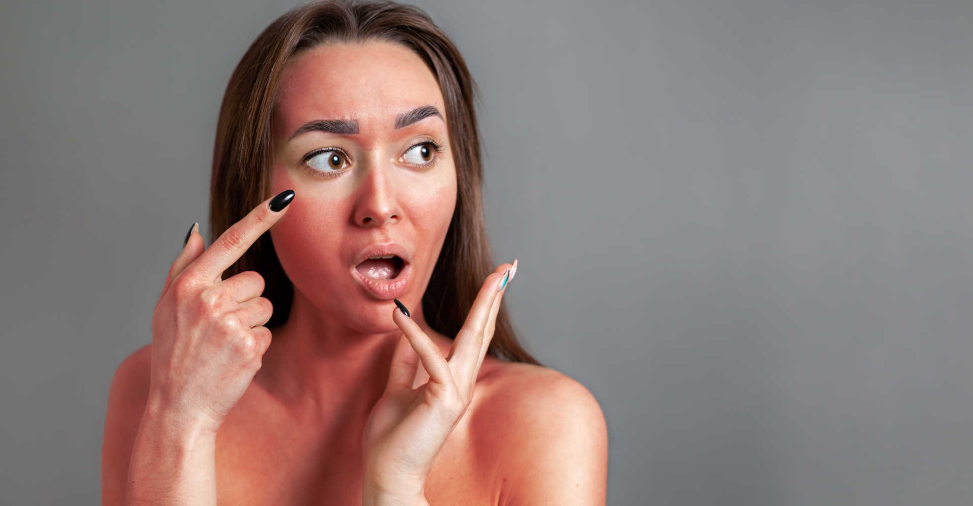 Modelo branca queimada de sol