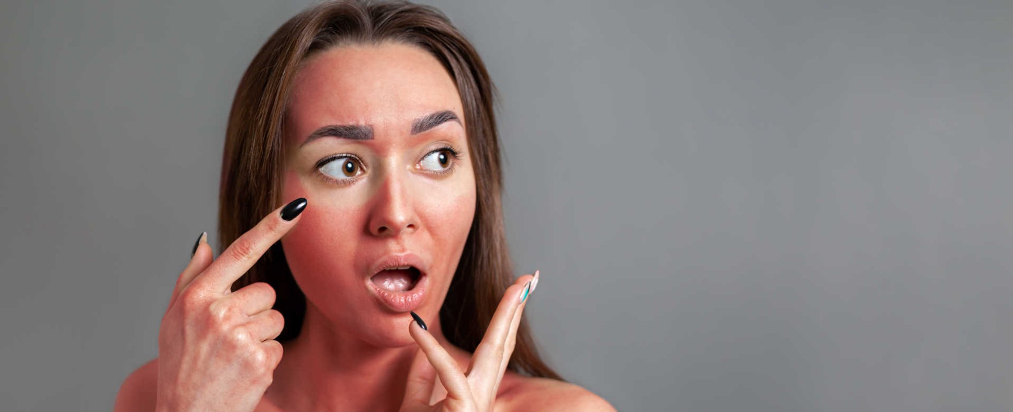 Modelo branca queimada de sol