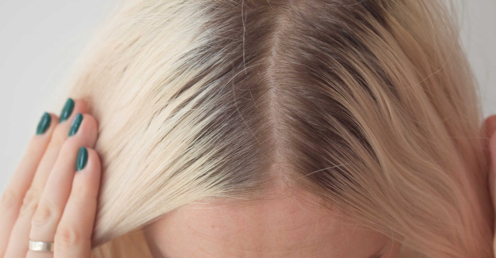 Imagem de uma raiz de cabelo preta