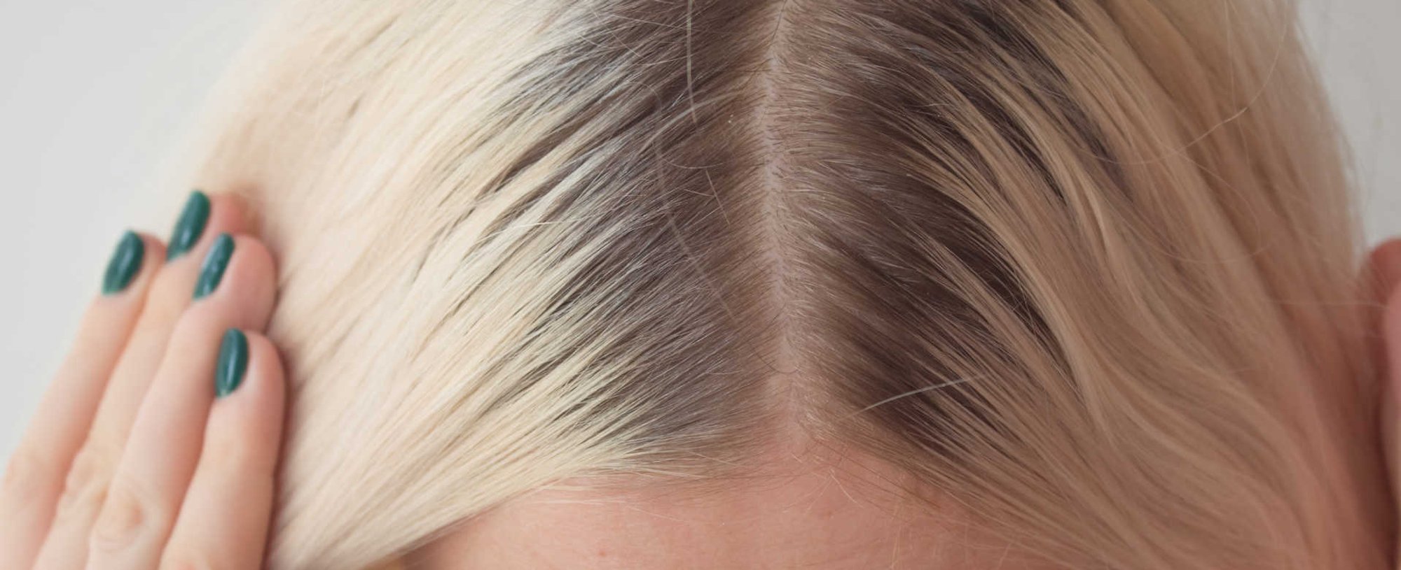 Imagem de uma raiz de cabelo preta