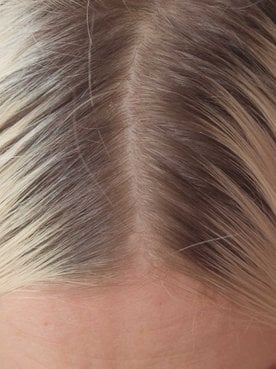 Imagem de uma raiz de cabelo preta