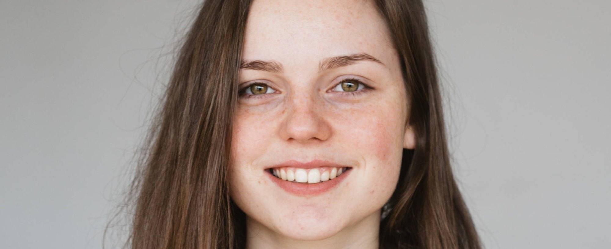 2924 Sardas O Que Sao E Como Elas Surgem Na Pele Confira As Explicacoes De Dermatologista