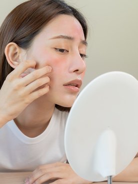 O que é dermatite? Saiba como ela surge e como tratar