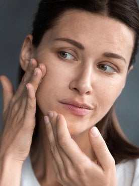 Manchas de acne: entenda como tratar | L'Oréal Paris