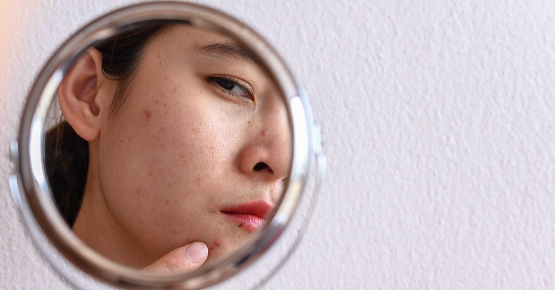 Moça com mancha de acne se olhando no espelho 