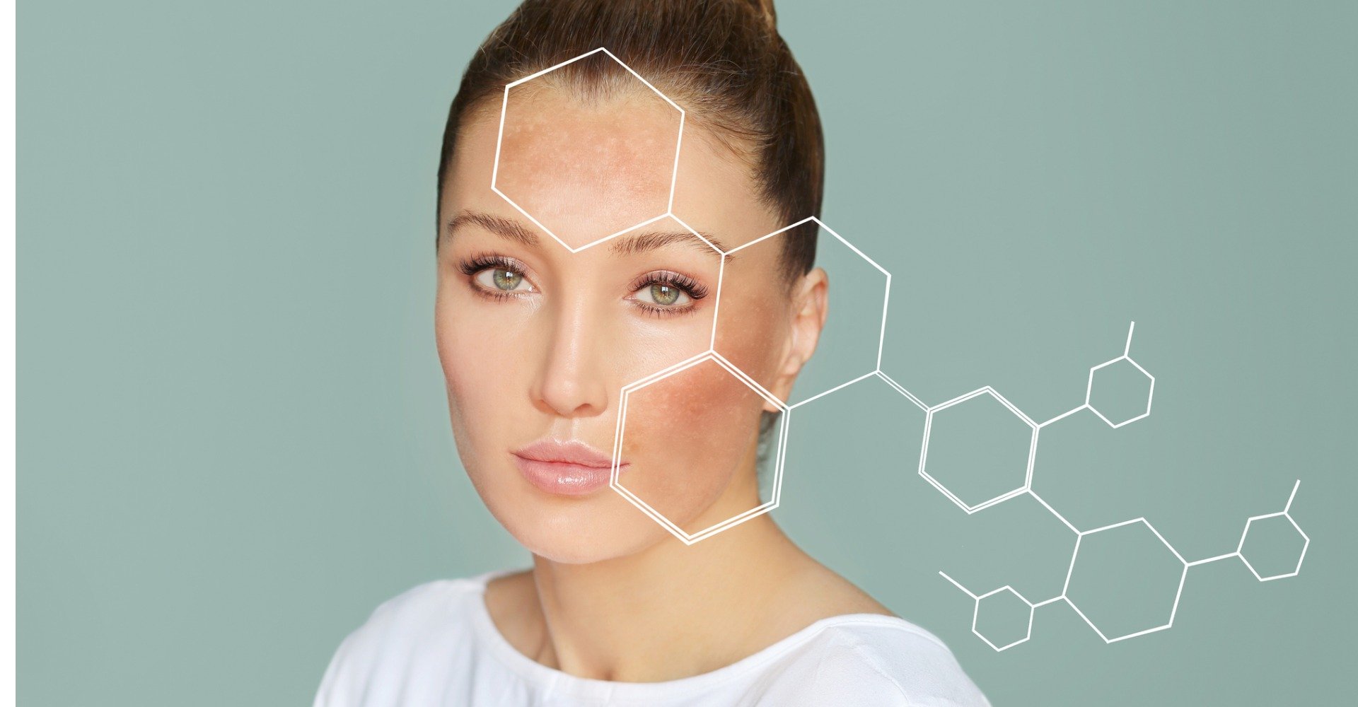 Dark Spots Freckleshyperpigmentationconcept Skin Lightening Skin Picture Id1270228406