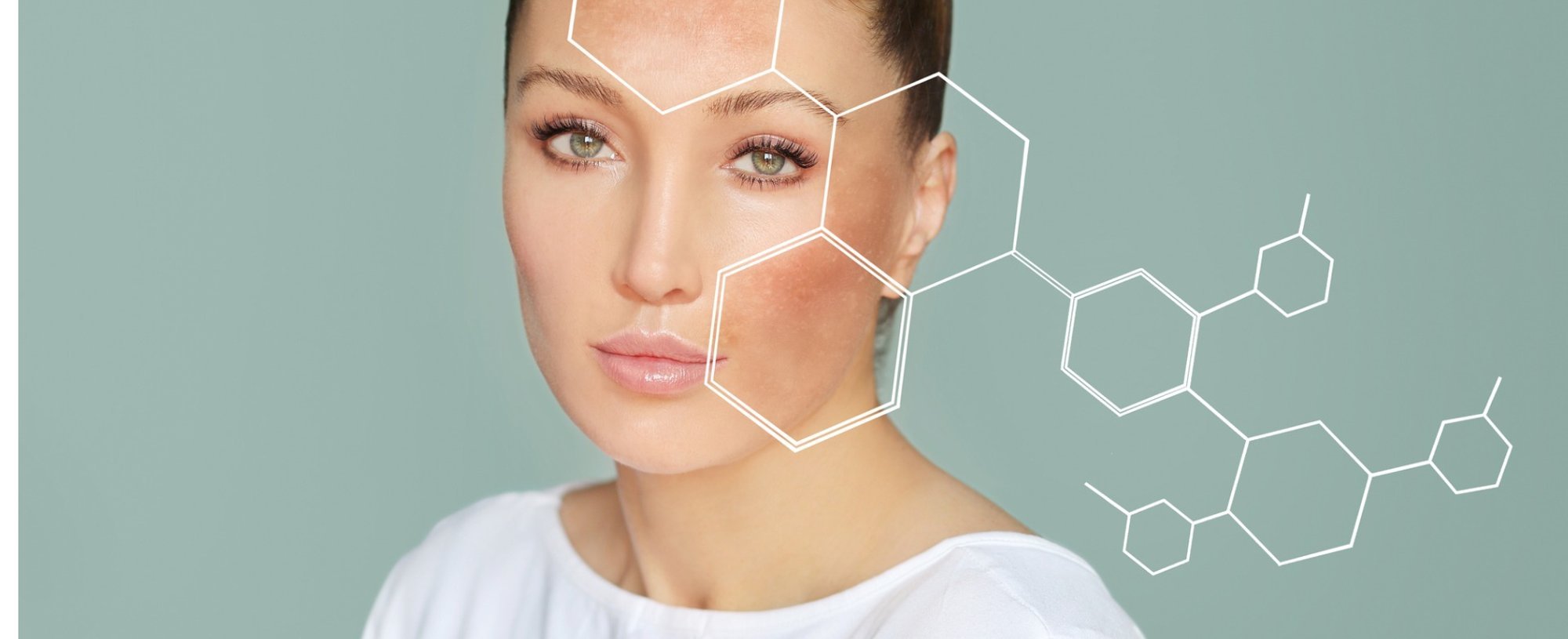 Dark Spots Freckleshyperpigmentationconcept Skin Lightening Skin Picture Id1270228406