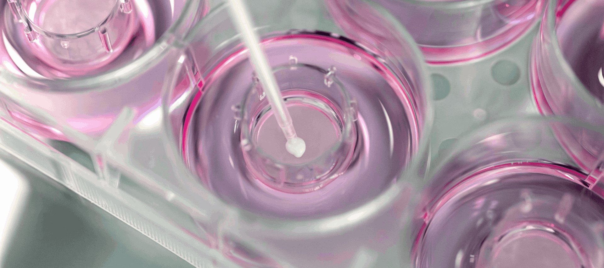 Análise de um pouco de produto em potinho de laboratório