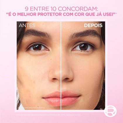 Comparativo antes e depois: pele com imperfeições visíveis vs. pele unificada após uso. 9 entre 10 consumidores aprovam como melhor protetor com cor.