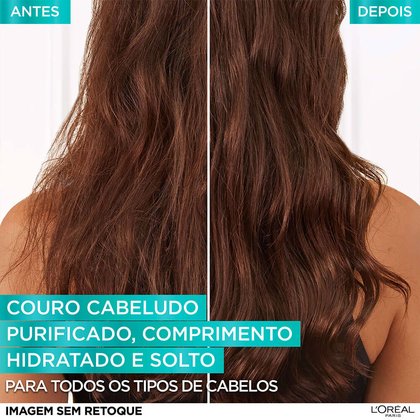 Imagem 72H' Tratamento Reequilibrante 300g | Antes e Depois | Pure Hialurônico | L'Oréal Paris