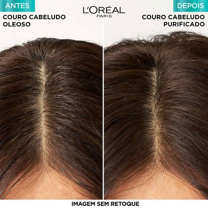 Imagem Shampoo Micelar Antioleosidade 300ml | Antes e Depois | Pure Hialurônico | L'Oréal Paris