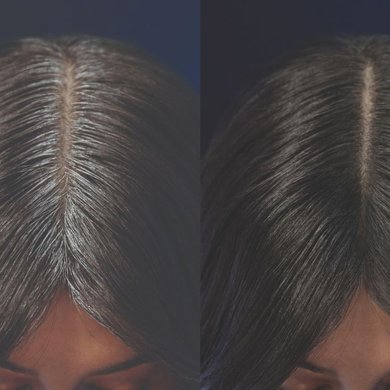 Testimonials Antes E Depois 2