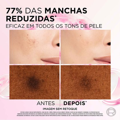 Imagem Sérum Anti-Marcas | Antes e Depois | Glycolic - Bright | L'Oréal Paris